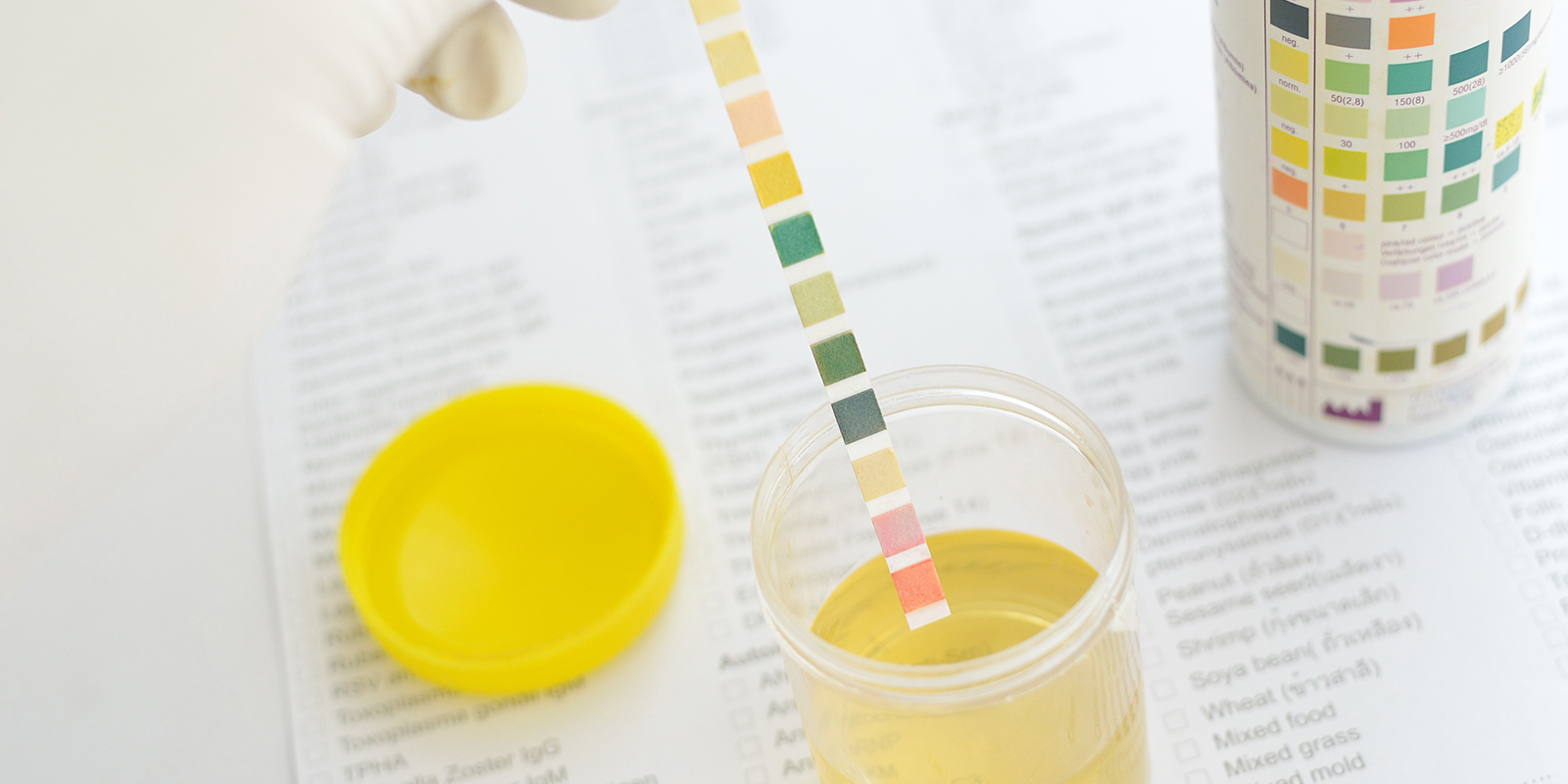 Puolitotuuksia: detox-juomat, näytteen vaihto & synteettinen virtsa Puolitotuuksia: detox-juomat, näytteen vaihto & synteettinen virtsa