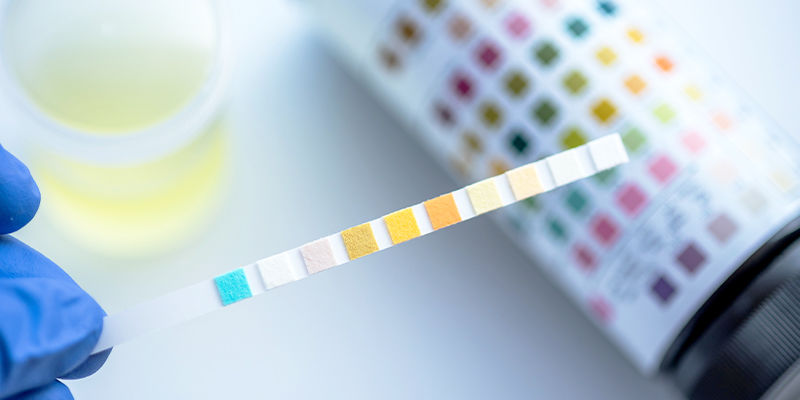 Miten THC-huumetestit toimivat? Miten THC-huumetestit toimivat?