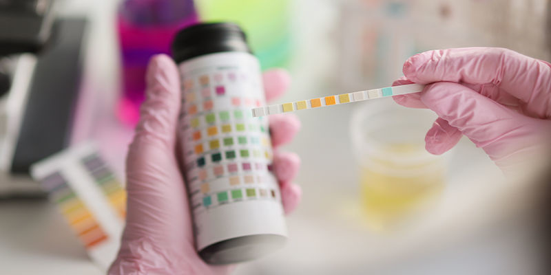 Kratom huumetestaus Kratom drug testing