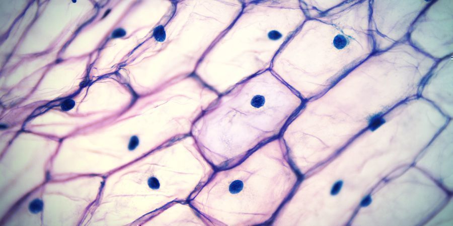 Vakuolit VACUOLES